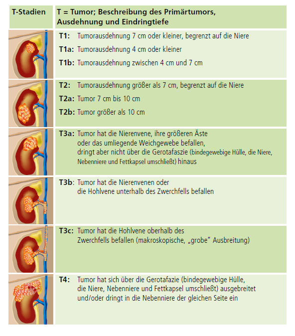 TNM Klassifikation